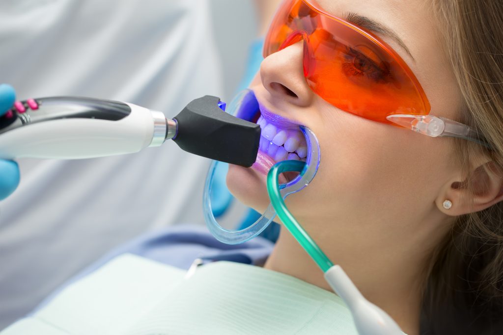 بلیچینگ دندان با اشعه ماورای بنفش UV-A