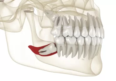 جراحی در نسج سخت