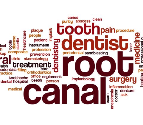 باورهای نادرست در مورد عصب کشی دندان
