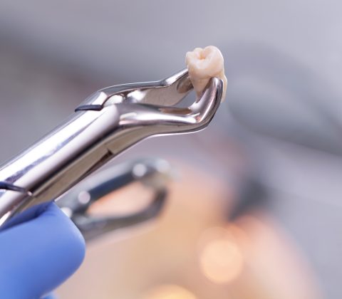 ابزار کشیدن و جراحی دندان عقل