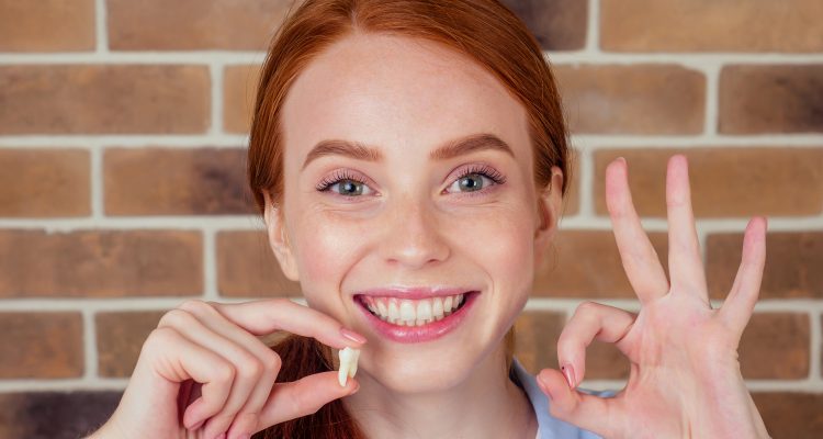 آیا دندان عقل به طور طبیعی می افتد؟