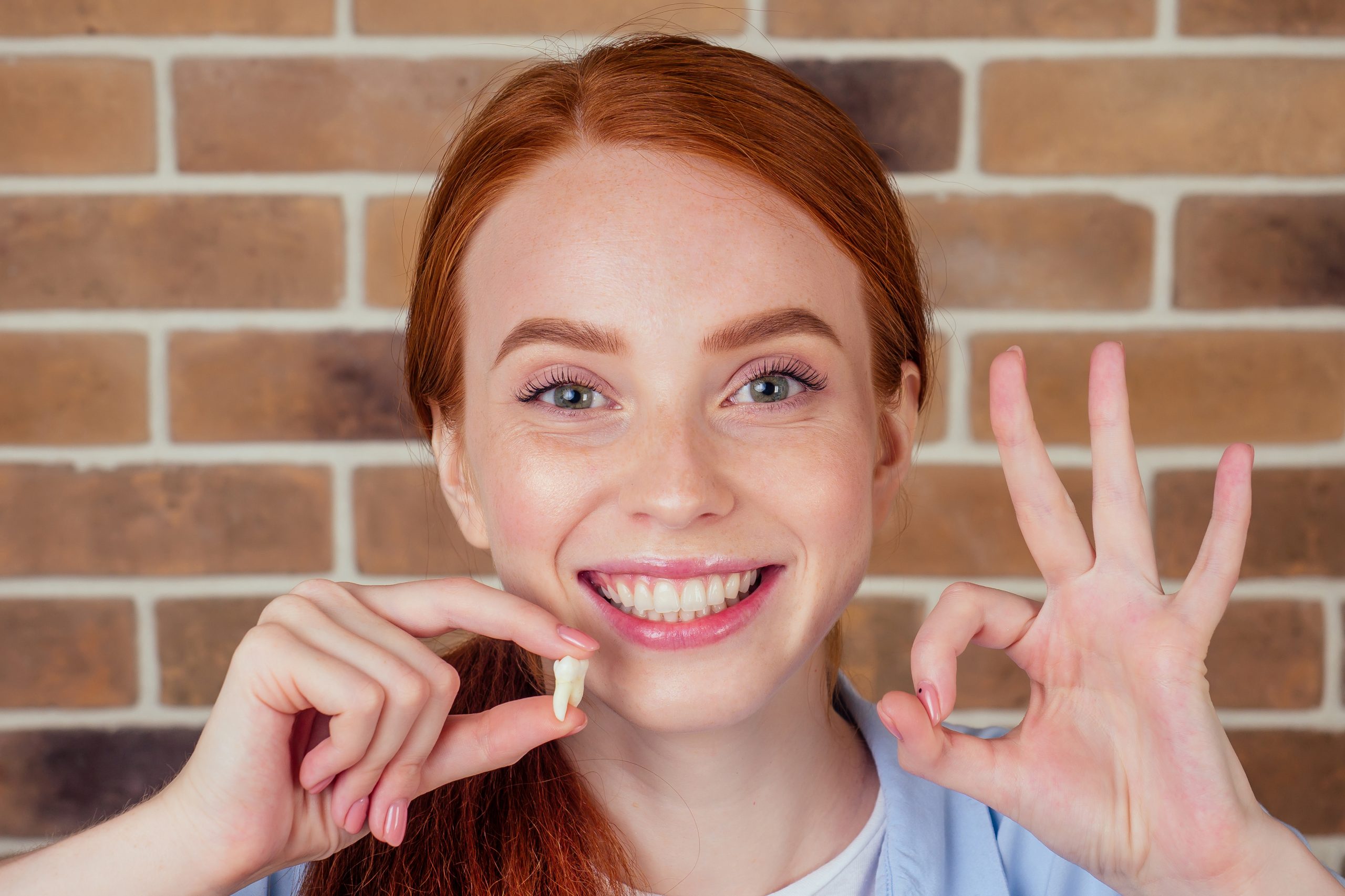 آیا دندان عقل به طور طبیعی می افتد؟