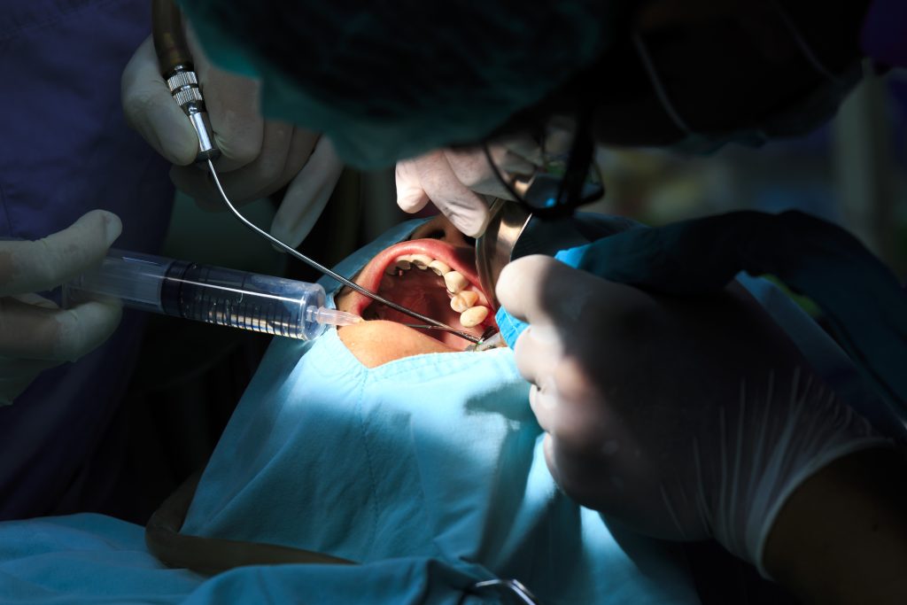 متخصص جراح فک و صورت در حال جراحی امیپلنت