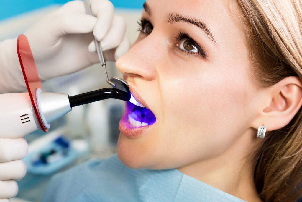 دندانپزشک در حال تابش اشعه فرابنفش توسط لایتکیور به کامپوزیت نانوسرامیک