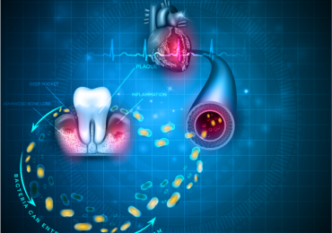 بیماری های قلبی و عروقی ناشی از پوسیدگی و خرابی دندان
