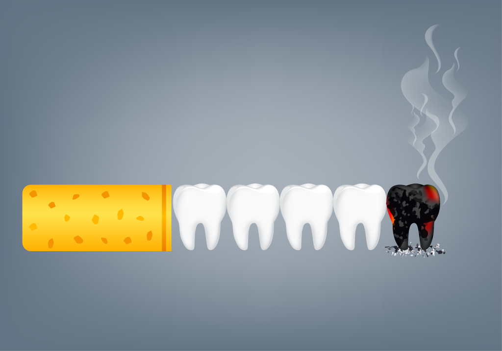 تاثیر سیگار بر پوسیدگی و تحلیل لثه و خرابی و کشیدنی شدن دندان ها و نیاز مکرر به دندانپزشکی برای عصبکشی و کشیدن دندان ها