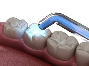 دندانپزشکی ترمیمی