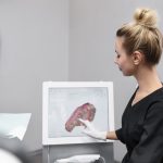 قالبگیری دیجیتال با اسکنرهای سه بعدی روکش دندانی